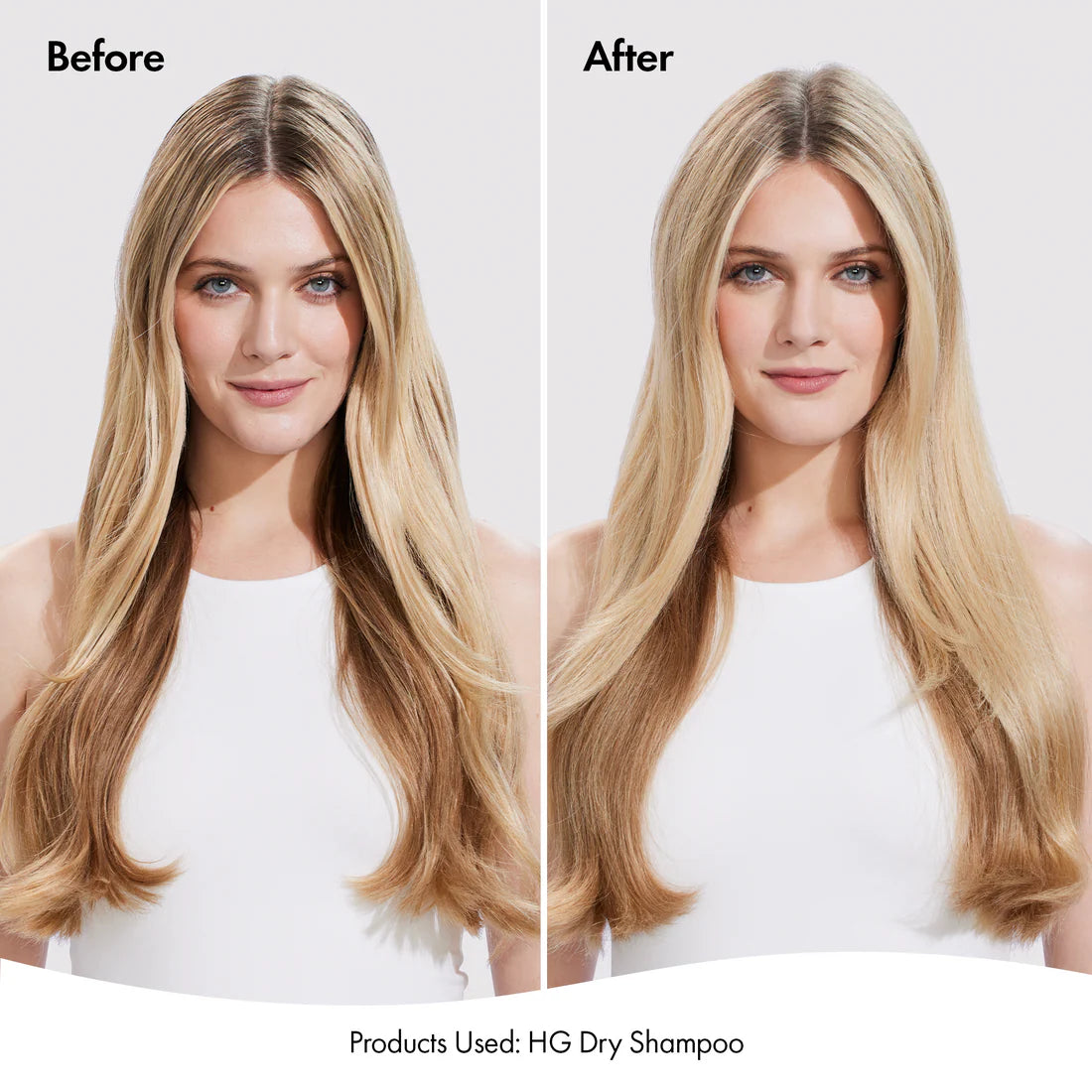 Bondi boost Hair Growth Dry Shampoo 200ml