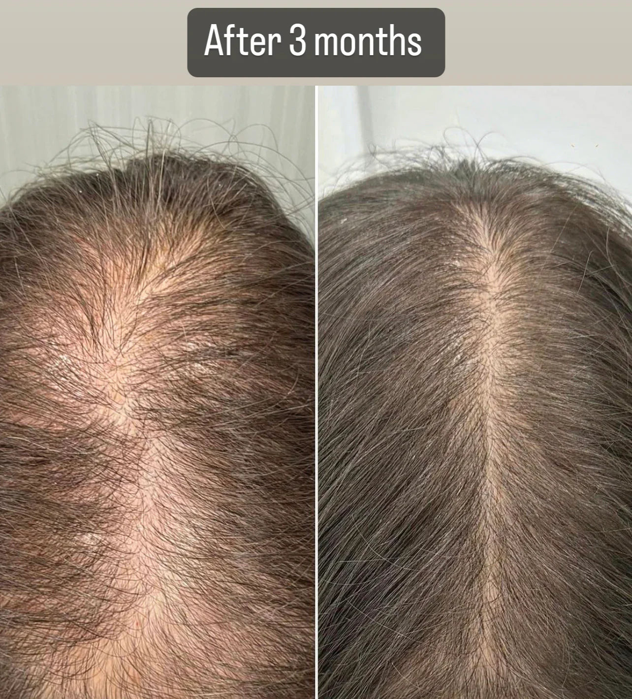 Milkshake Energising Blend Pack (for hair loss) 📣