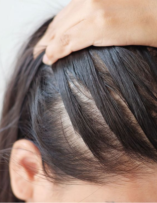 Oily Roots