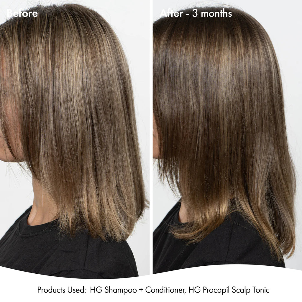 Bondi Boost anti-thinning super system pack 📣