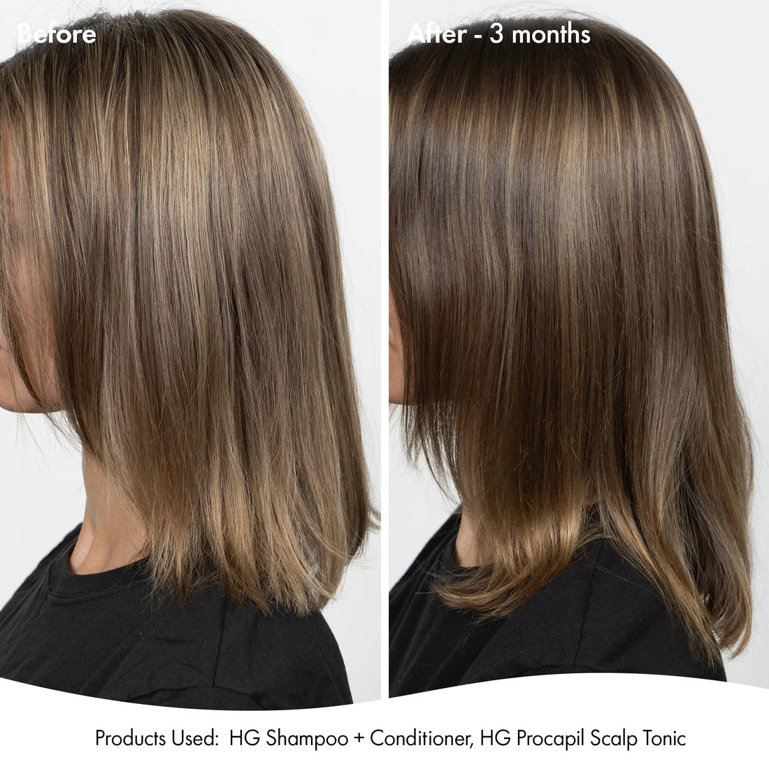 Bondi Boost anti-thinning super system pack 📣