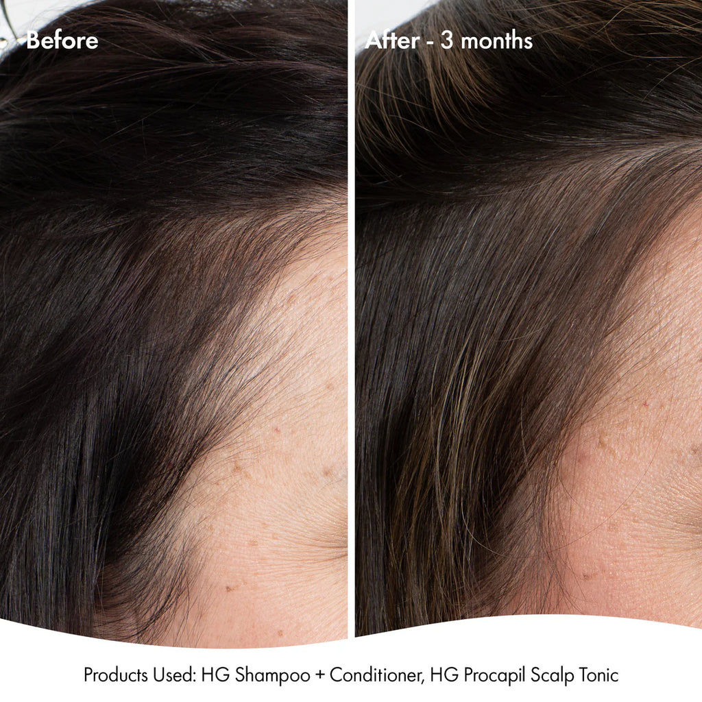 Bondi Boost anti-thinning super system pack 📣