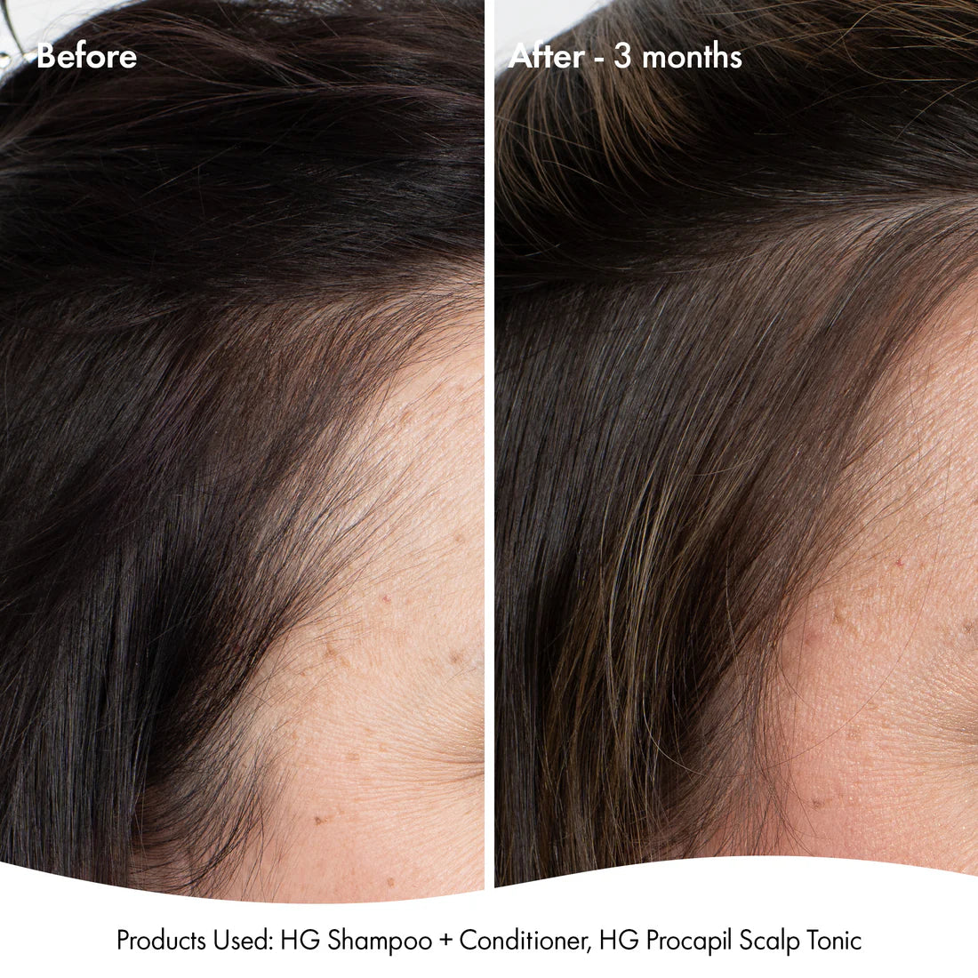 Bondi Boost anti-thinning super system pack 📣