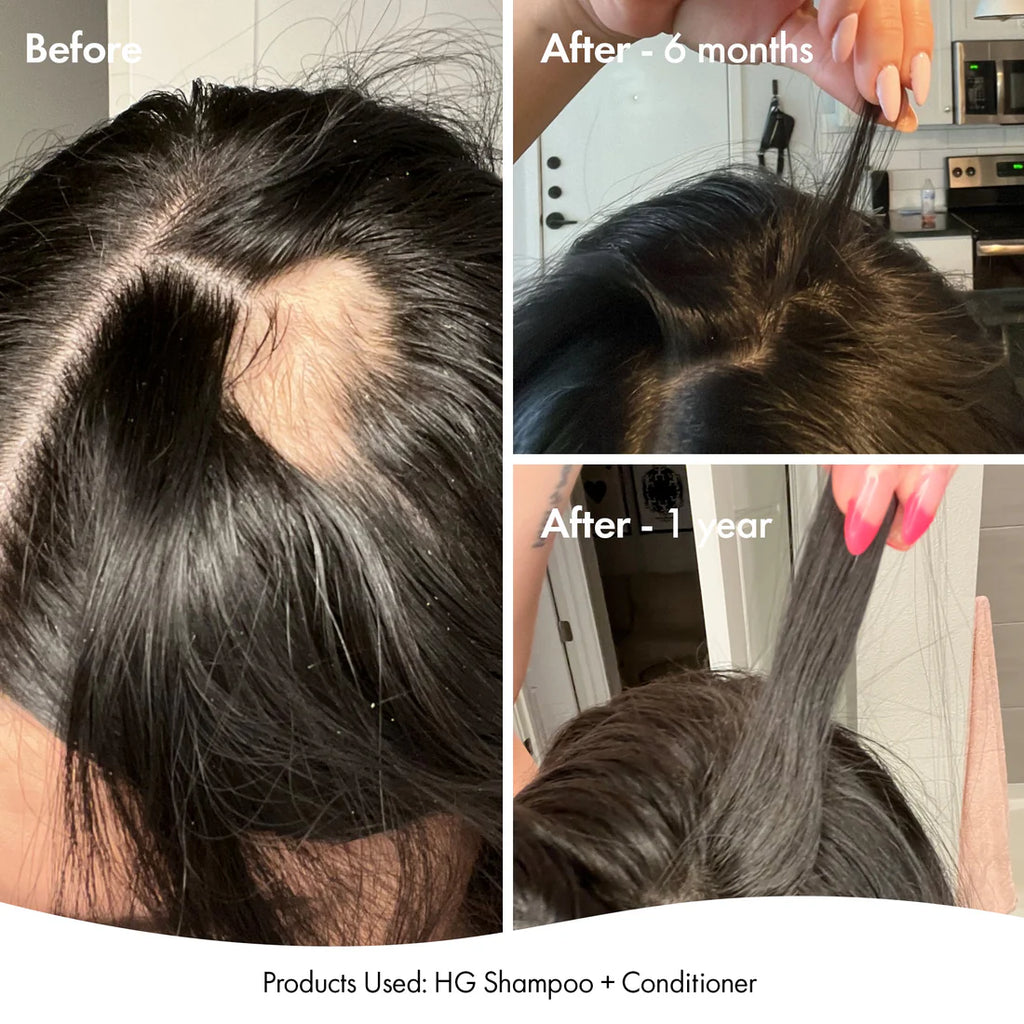 Bondi Boost anti-thinning super system pack 📣