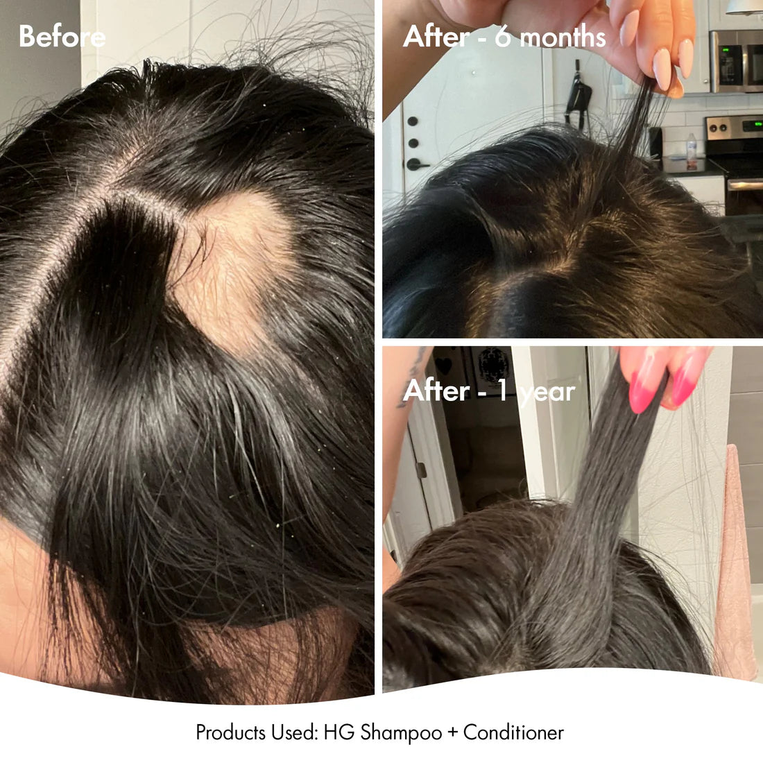 Bondi Boost anti-thinning super system pack 📣