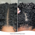 Bondi boost dandruff Repair Leave-In Scalp Serum 125ml